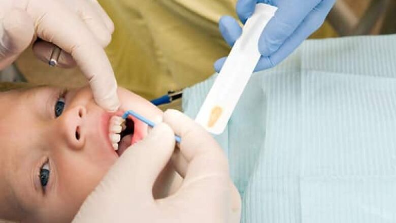 Child with mouth open as gloved hands apply something to the teeth.