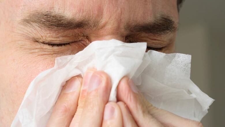 Close-up of man sneezing into a wad of tissues. 