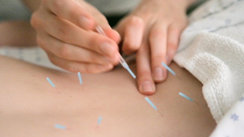 Needles poked into a back. 