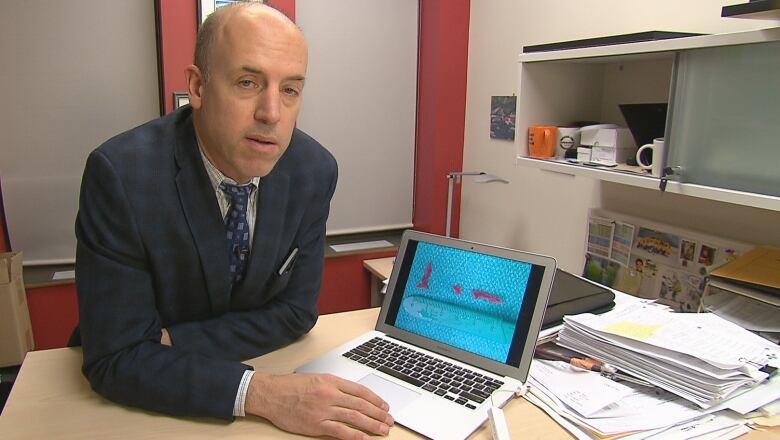 A man in a suit leans over a desk, looking at the camera. Behind him is a laptop showing pieces of a clot retrieved from a stroke patient.