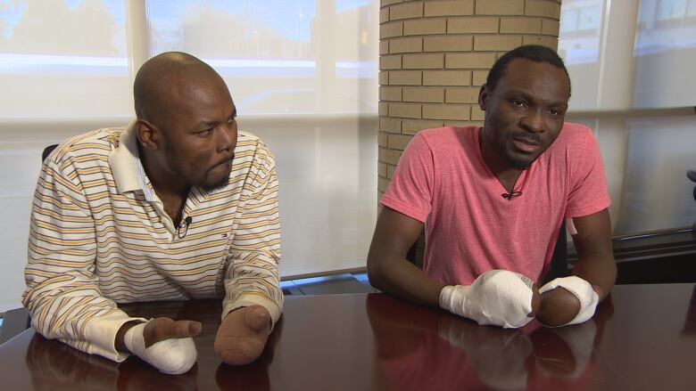 Two men wuith bandages on their hands sit at a table.