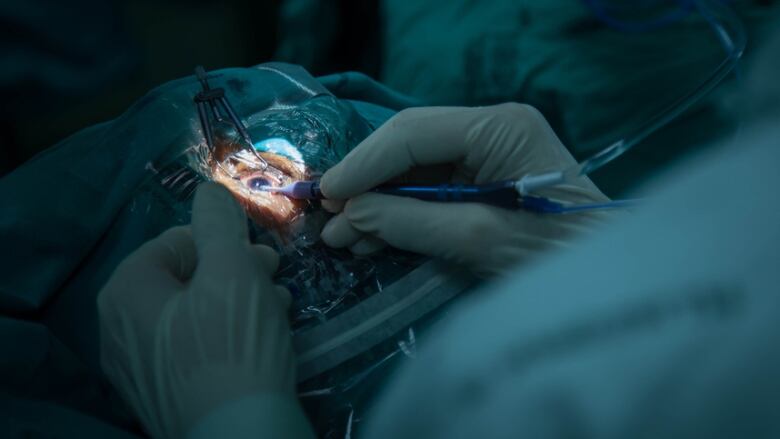 A doctor's gloved hands are shown in closeup as they perform a cataract surgery on a patient's wide open eye.