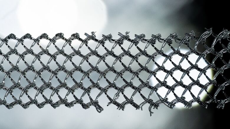 A close-up of surgical mesh with a broken section at the bottom.