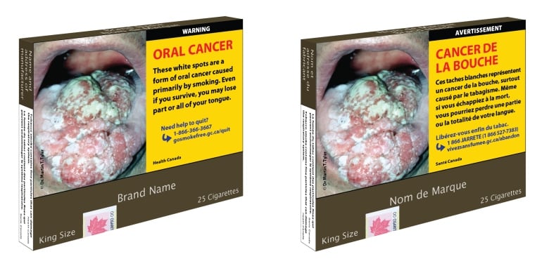 Cigarette package with warning about oral cancer