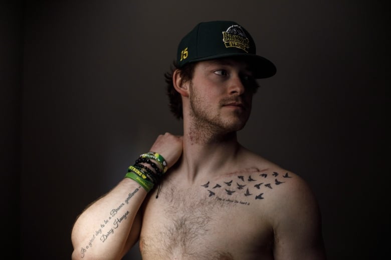 Humboldt Broncos bus crash survivor Tyler Smith shows his tribute tattoos in Leduc, Alta., on Saturday, March 30, 2019. Over a year after a deadly bus crash that devastated their junior hockey team and the nation, Smith and Kaleb Dahlgren are focusing on healing and building their futures.