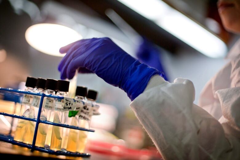 A hand in a rubber glove pulls one test tube from a tray.