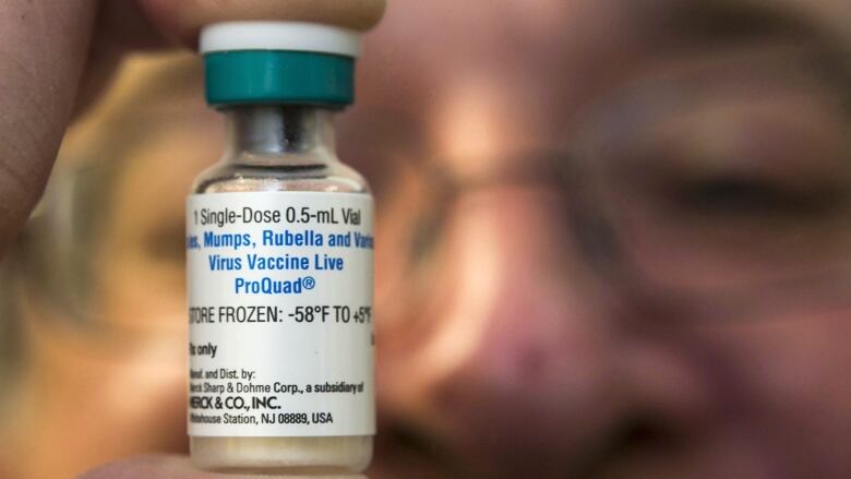 A close-up of a man holding a measles, mumps, rubella and varicella (MMR) vaccine vial between his right thumb and index finger, in front of his face.