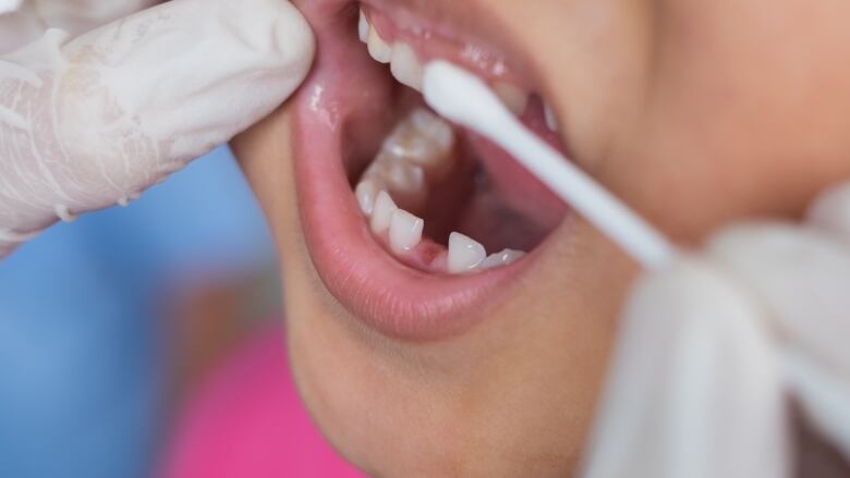 A dentist examines a child's teeth.