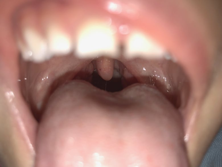 The inside of a boy's mouth.