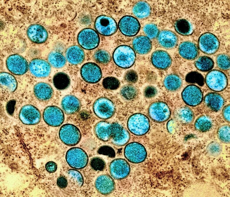 Microscope image showing teal cells against brown cells