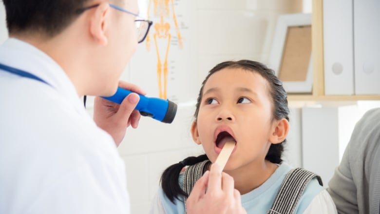 A young girl opens her mouth for a doctor doing oral examination.