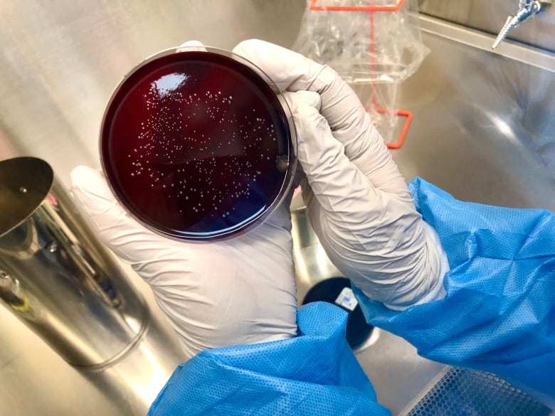 A gloved hand holds a Petri Dish.