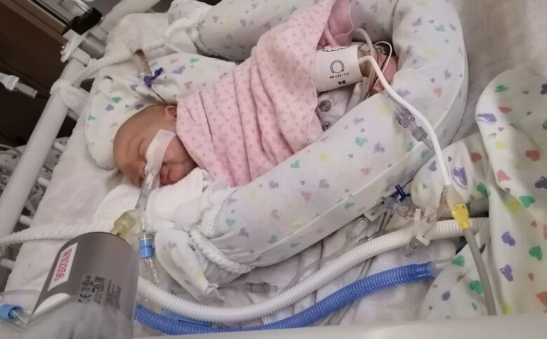 A baby wrapped in a pink blanket lies in a hospital bed, with tubes running into her nose.