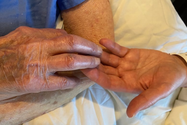 Two hands touch just by the fingers. One hand is deeply wrinkled and a bit swollen. 