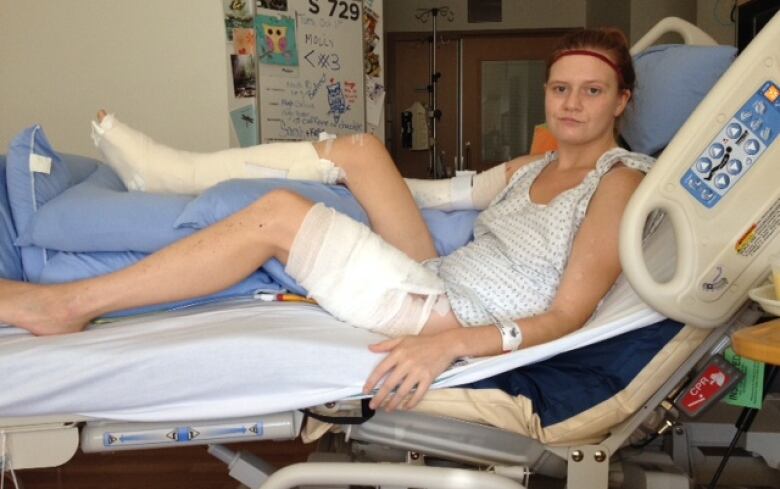 A woman in a hospital bed with bandages on her leg and arm.