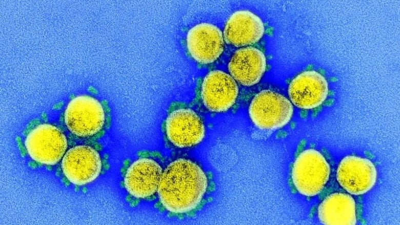 A colourized electron microscope image of SARS-CoV-2, the virus behind COVID-19. Scientists are now watching the Omicron subvariant XBB.1.5, which is on the rise in multiple countries, including the U.S. 