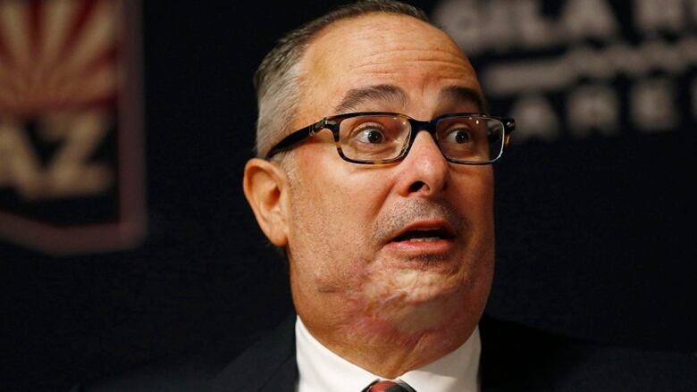 Men's minority owner of NHL team changes facial expression during news conference.