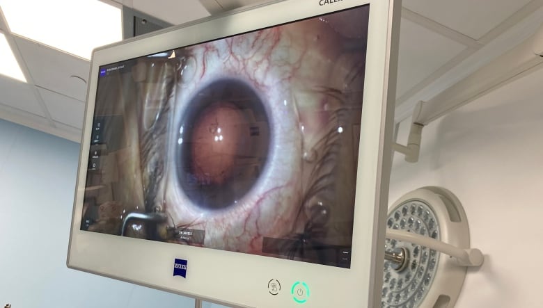 A person's eyeball is show on a monitor.