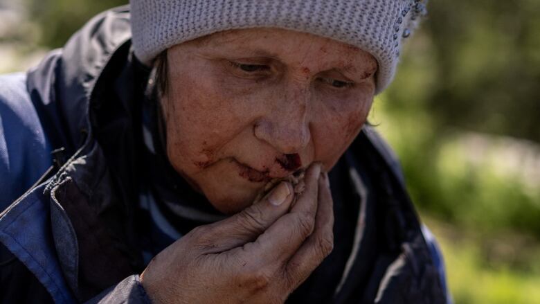 A wounded woman sits outside a train station hit by a Russian military strike in Kherson, Ukraine.