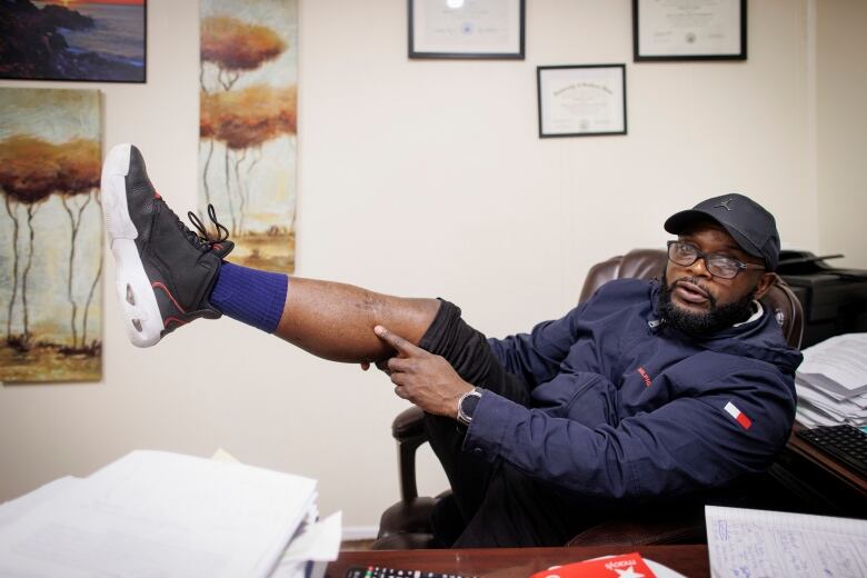 A man in an office chair leans back, pointing to his shin, where a rolled-up pant leg reveals a bullet wound. 