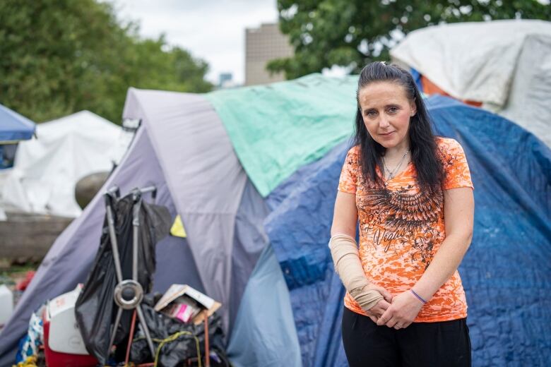 A woman dressed in orange and a bandage on her arm posing in front of her tent