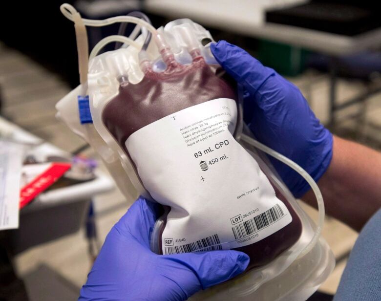 A bag of blood is shown at a clinic in Montreal, Thursday, November 29, 2012.