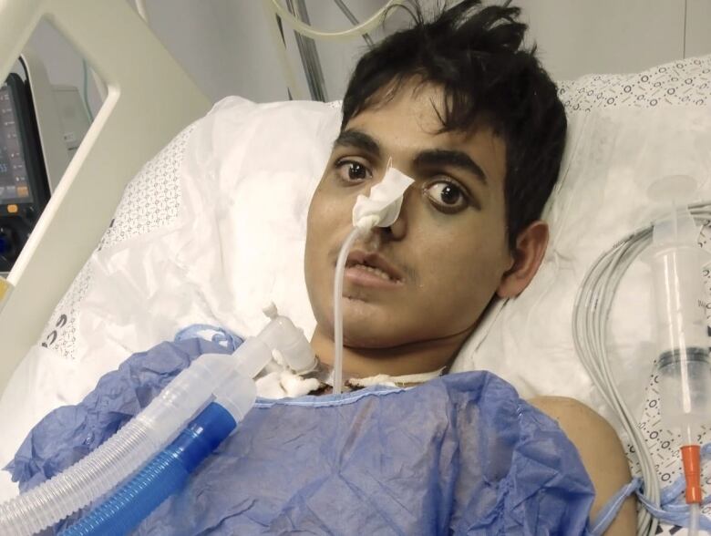 A teenage boy in hospital bed.