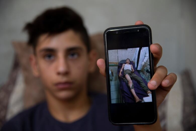 A young man holds up a cellphone showing a photo of himself injured.