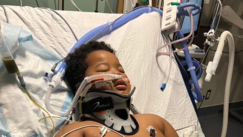 A young boy lies in a hospital bed attached to a breathing tube. 