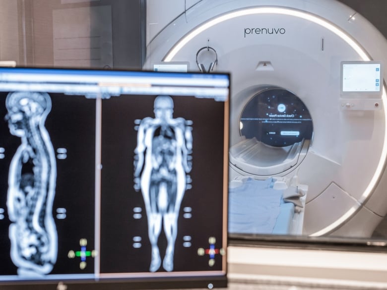 A full-body MRI machine operated by Prenuvo, behind a computer screen showing whole-body scans of a patient.