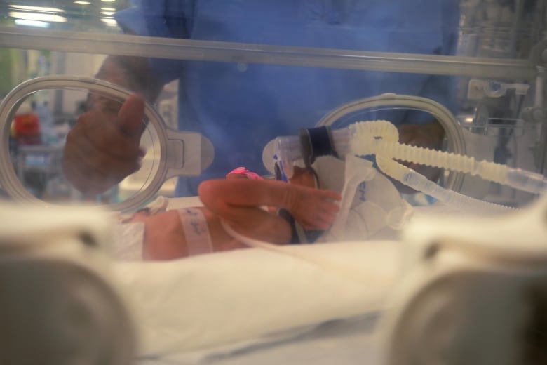 A newborn baby lying inside an incubator is seen connected to a machine to help her breathe.