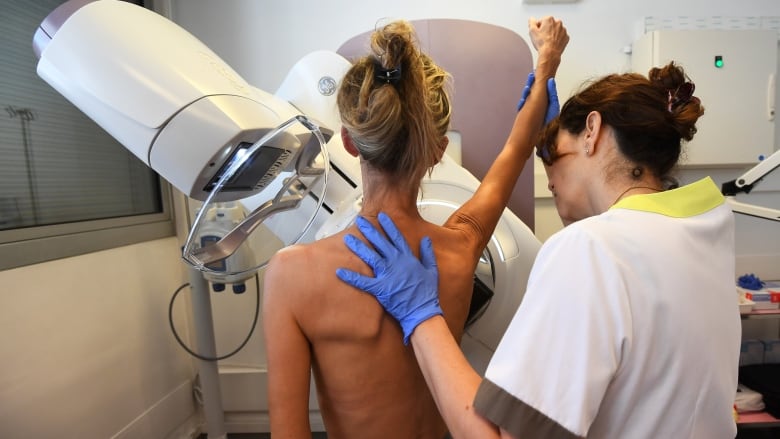 A patient is pictured before a mammography.