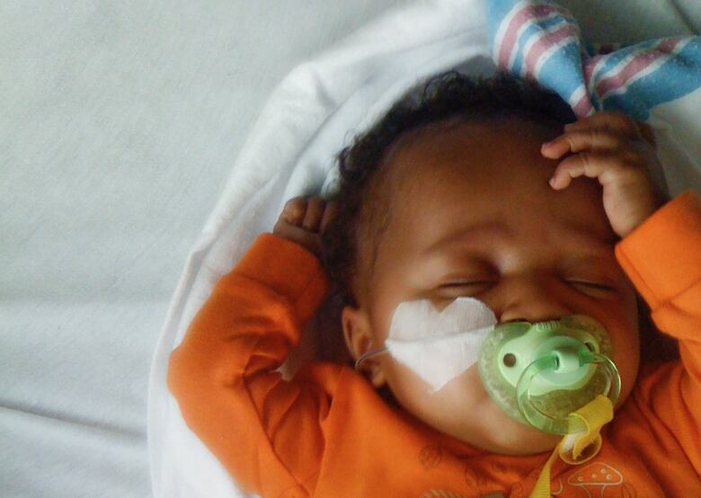 A baby wearing an orange jumping, with a heart-shaped piece of tape that holds a tube to her nose on her cheek. 