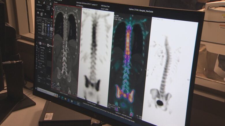 A screen shows X-rays in both black and white and colour.