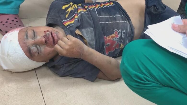 A boy with a bandaged head and blood caked to his face lays on a hospital floor crying as doctors treat his injuries. 