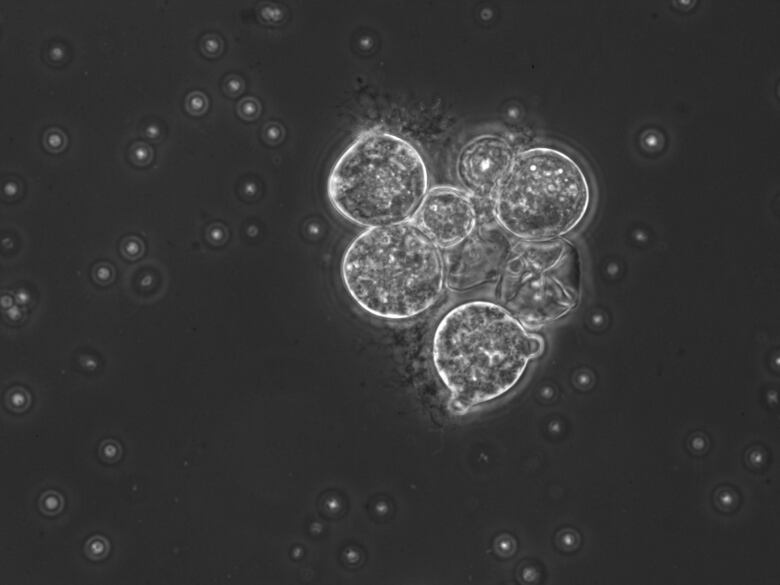 A gray and white micrograph image of a chytrid fungus,