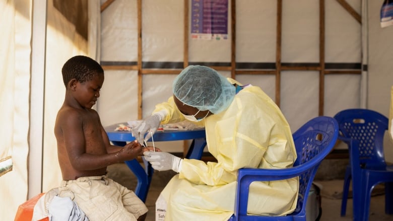 A nurse takes a sample from a child declared a suspected case of mpox at a treatment centre in the Democratic Republic of Congo in July 2024. 