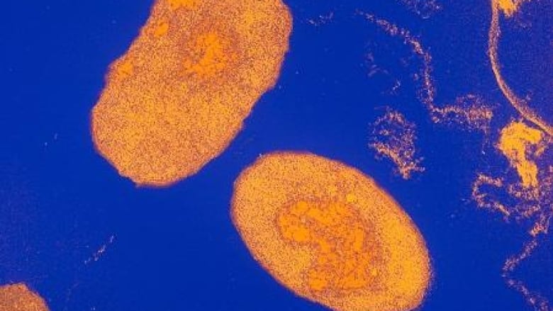 An electron microscope image of the bacteria Bordetella pertussis, which causes whooping cough.