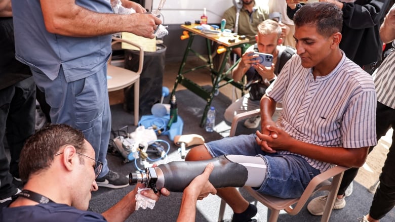 A man with an above-the-knee amputation is fitted with a new prosthetic limb.