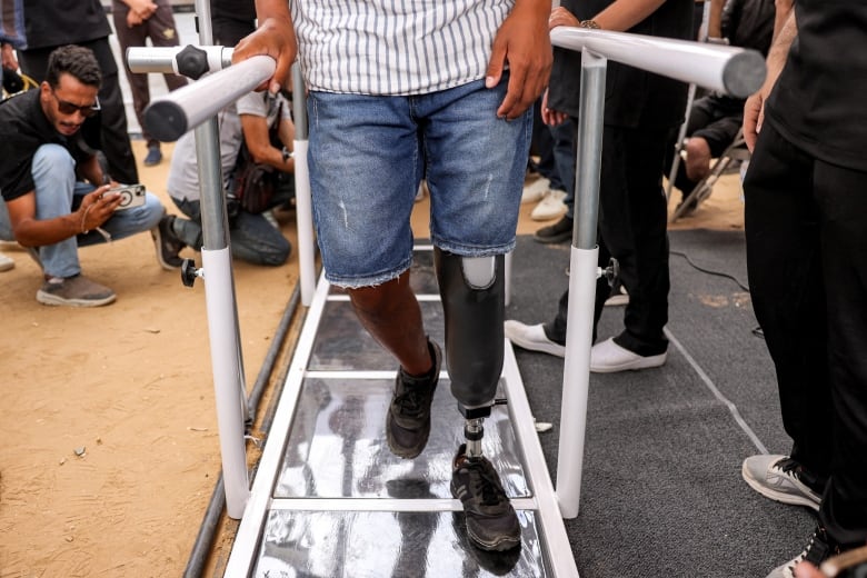 A man with a new prosthetic leg practices to walk.