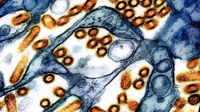 A colourized electron microscope image provided by the U.S. National Institute of Allergy and Infectious Diseases in 2024 shows avian influenza A virus (bird flu) particles, red/yellow, grown in cultured cells.  