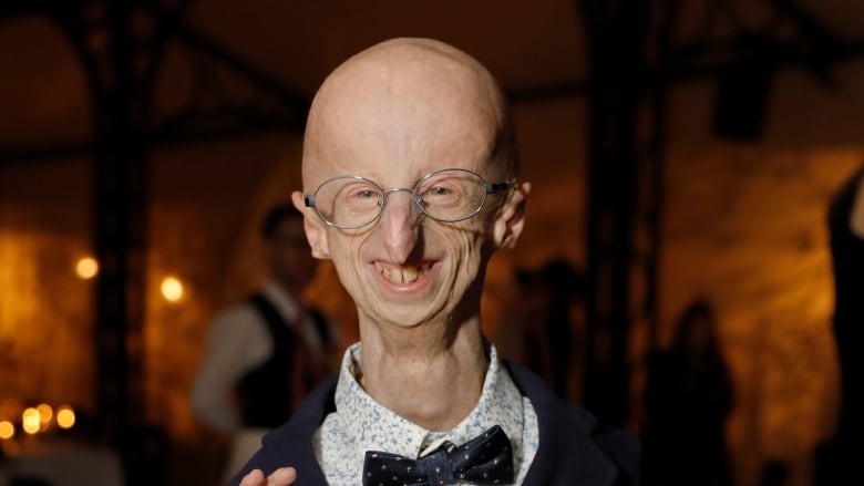 A man in a tuxedo and bowtie smiles and makes an Italian hand gesture. He's very short, with a large, bald head and glasses. 