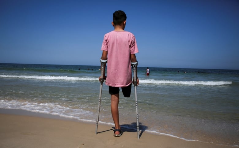 A boy who lost a leg uses crutches as he stands on a beach with his back to the camera, looking out at the water.